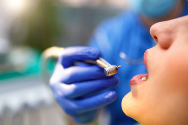 Best Wisdom Tooth Removal  in Miller, SD